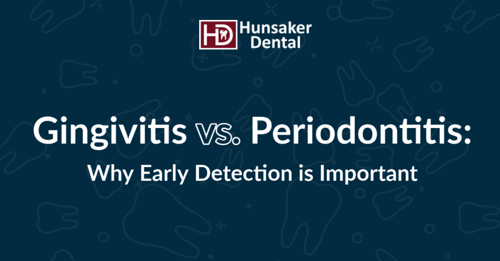 Periodontitis vs. Gingivitis