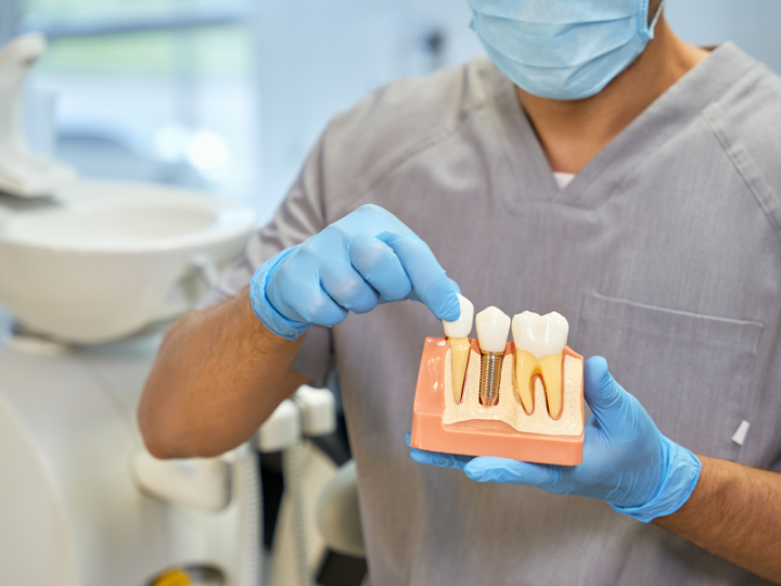 dental implant anatomy at Hunsaker Dental in Salem and Monmouth