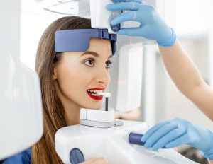 Full Mouth Dental Implants - Hunsaker Dental